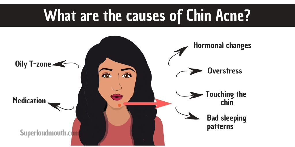 Pimples On Chin Meaning How To Get Rid Of Break Out On Chin